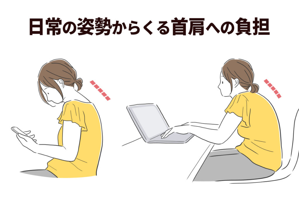 肩こり、ストレートネック姿勢